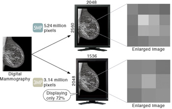 Delicate Grayscale Shadings of Digital Mammography