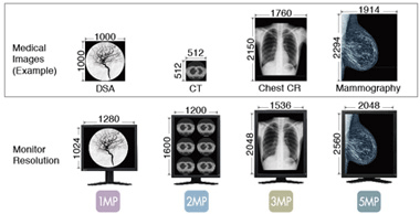 Medical Image and Monitor Resolution