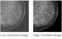 gamma_correction